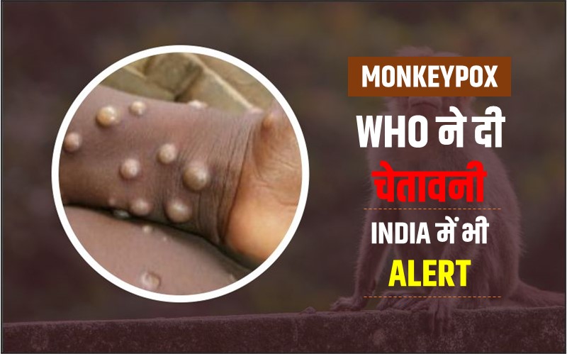 MONKEYPOX IN INDIA