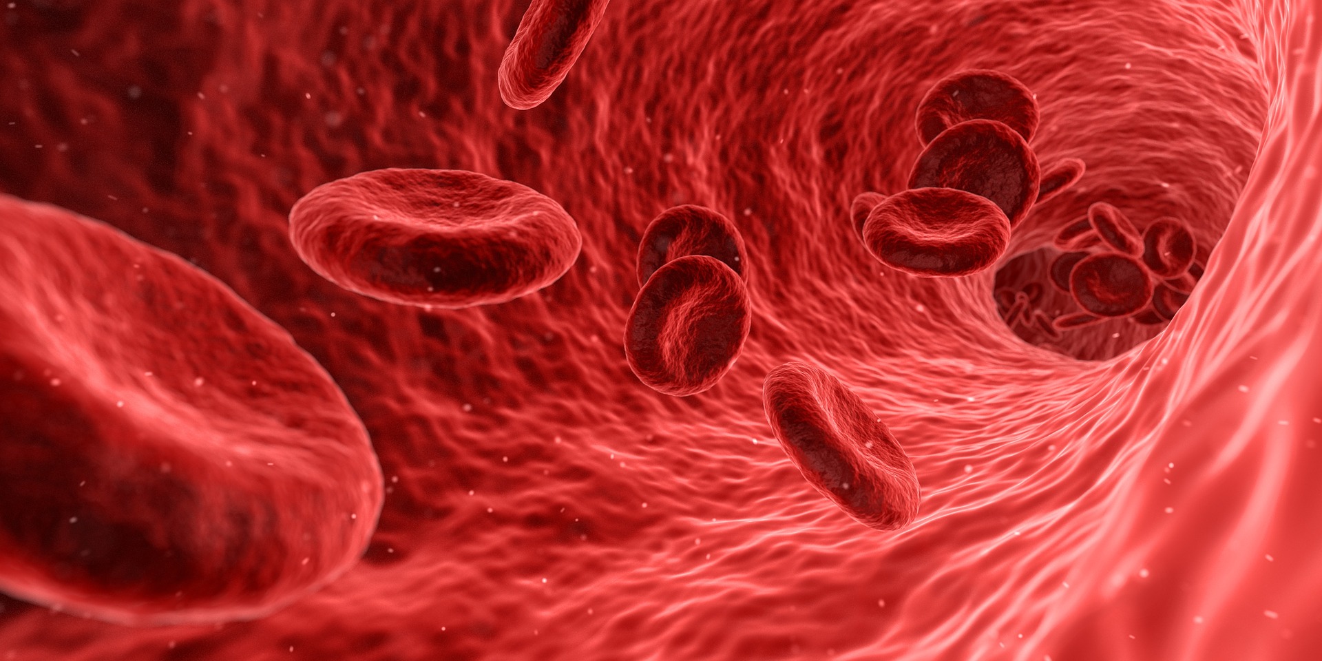 anemia (https://pixabay.com)